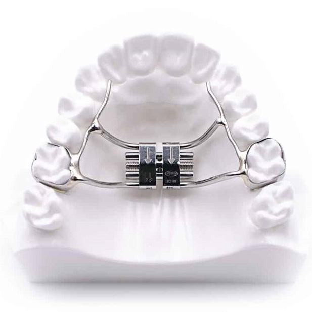 Disjoncteur orthodontie