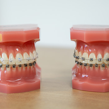 Multi-attaches orthodontie